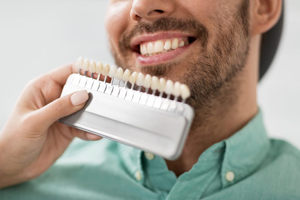 What are tooth veneers?